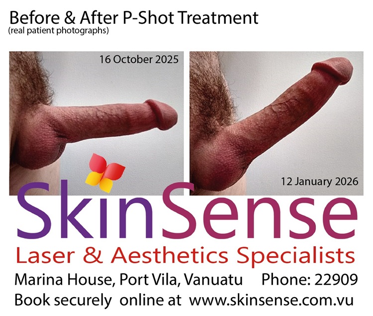 P Shot before and after photographs