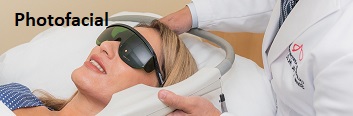 IPL Photofacial Treatments